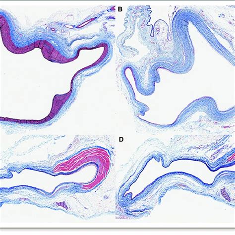 Slide Sections With Elastic Massons Trichrome Stain Demonstrating A