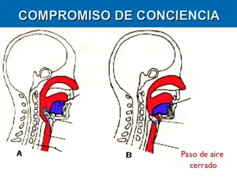 Rcp Basico Y Avanzado