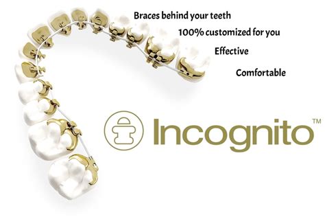 Incognito Lingual Braces | Specialist Orthodontics | Specialists In ...