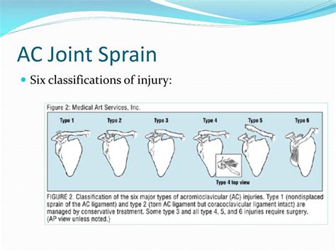 Ppt The Shoulder Evaluation And Treatment Of Common Injuries Powerpoint Presentation Id 245878