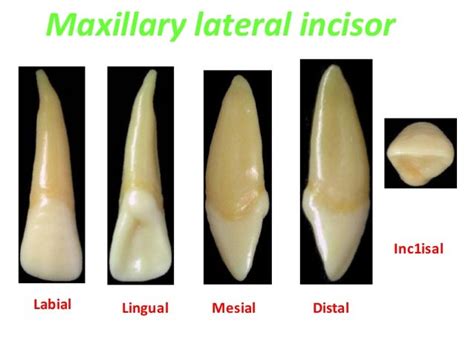 Upper Lateral Incisor