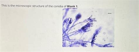 Solved This is the microscopic structure of the conidia of | Chegg.com