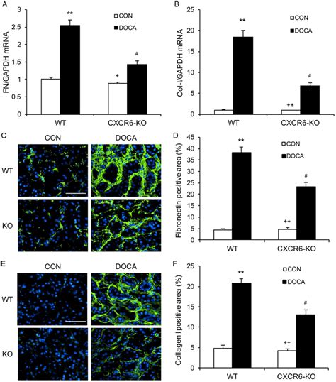 Disruption Of Cxcr Inhibits Fibronectin And Collagen I Expression A