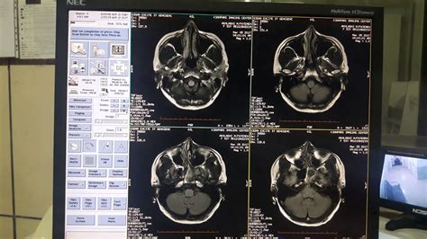 Mri Education Part One Introducing Brain Protocols آموزش ام آر آی