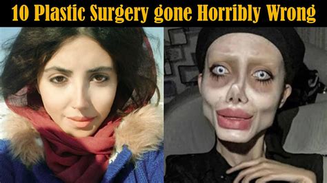 Celebrities Plastic Surgery Gone Horribly Wrong Youtube