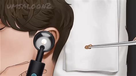 Asmr Ear Wax Removal And Cleaning Asmr Animation Youtube