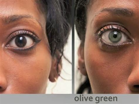 Laser Eye Color Change Uk Allright Weblog Stills Gallery