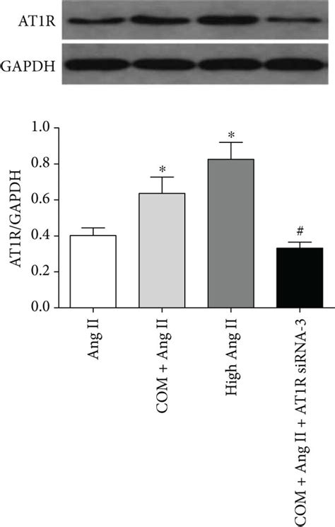 Caox Induced Ros Generation And Overproduction Of Stone Related