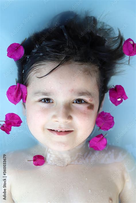 retrato de niño mojado tumbado en la piscina con una herida en la cara