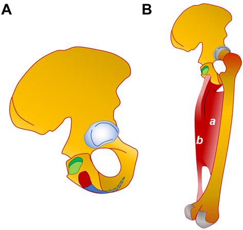 Isolated Adductor Magnus Injuries In Athletes A Case Series Sandra