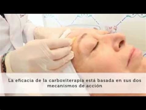 Beneficios De La Carboxiterapia Cl Nica Baleares Per Youtube