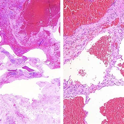 A Low Power Microscopic View Hematoxylin And Eosin Stain 20x