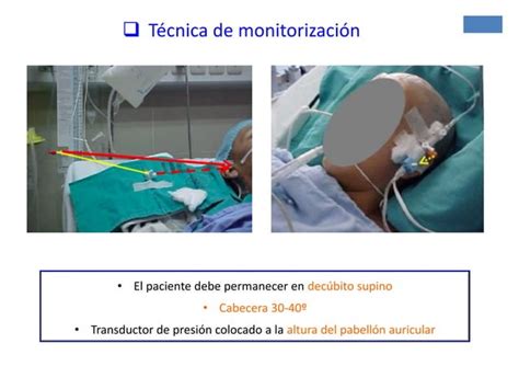 Ix 1 Neuromonitorizacion PPT