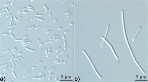 Lactobacillus Johnsonii Alchetron The Free Social Encyclopedia