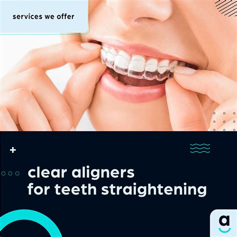 Transform Your Smile With Clear Aligners Access Dental Whitbourne