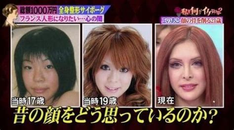 日本醜女花1000萬整容30次，從醜女變成了漂亮的「芭比娃娃」 每日頭條