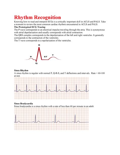 Rhythm Recognition Notes Rhythm Recognition Knowing How To Read And