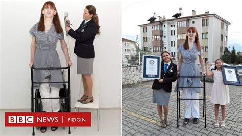 Tallest Woman In The World Turkey Rumeysa Gelgi Na Guinness World Records Holder Of Di Title