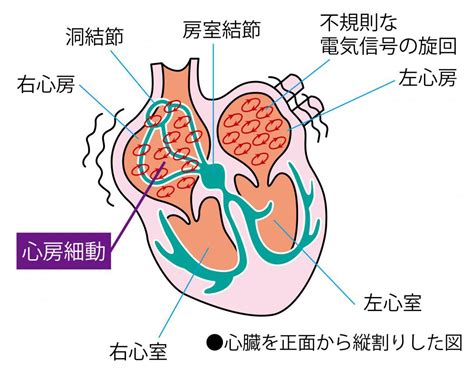 不整脈の種類をセルフ診断｜心房細動や期外収縮の脈拍がわかるグラフつき｜カラダネ