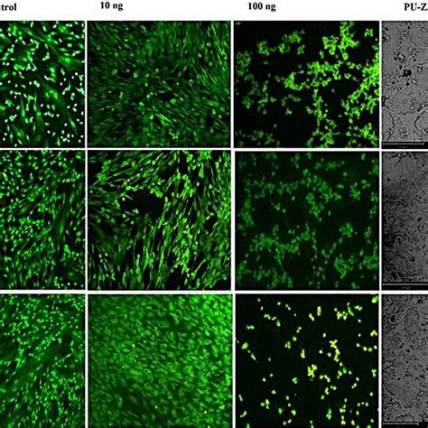 Acridine orange staining of TCPS, 10 ng, 100 ng, and PU-ZnO 1% ...