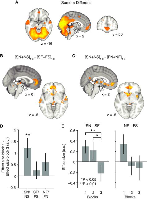 Learning Induced Plasticity In MPFC A Repetition Suppression As An