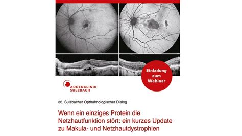 SOD Seminar Wenn ein einziges Protein Netzhautfunktion stört Ein