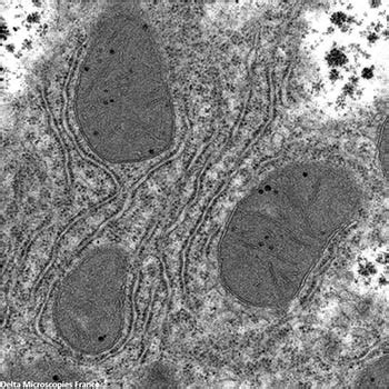 UranyLess efficient TEM staining solution is uranyl acetate free ...