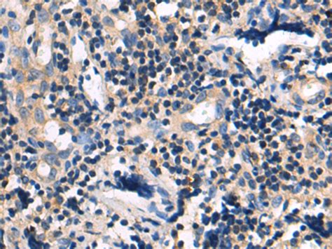 Sirt Anti Sirt Rabbit Polyclonal Antibody