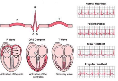 Different Heart Rhythms Cardiology Medical Nursing Notes