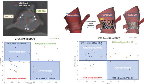 Computational Modeling Of Coronary Obstruction In Valve In Valve Tavr