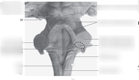 Cerebellar Peduncles (cadaveric) Diagram | Quizlet