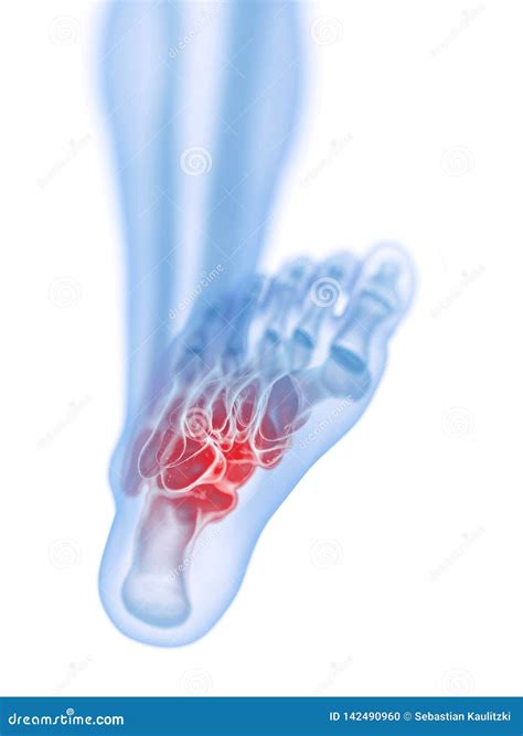 A painful foot stock illustration. Illustration of biology - 142490960