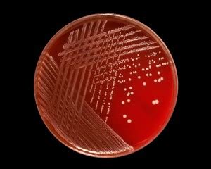 Staphylococcus epidermidis under microscope: microscopy of Gram ...