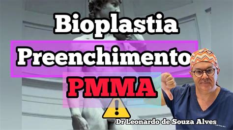 Bioplastia Peniana Pmma Cuidado Pmma