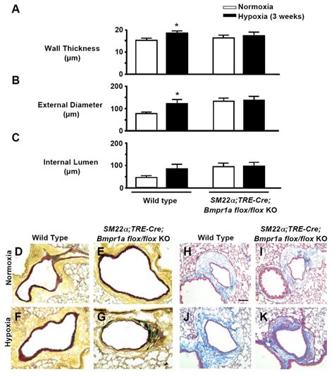 Smooth Muscle Protein 22alpha Mediated Patchy Deletion Of Bmpr1a