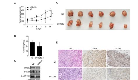 Cdc5l Knockdown Inhibited Tumor Growth By Down Regulating Htert Download Scientific Diagram