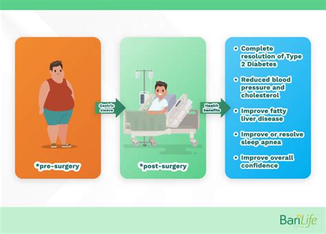 Getting the Most Out of Your Gastric Sleeve Results - Bari Life