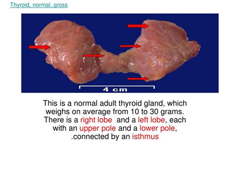 Ppt Thyroid Normal In Situ Gross Powerpoint Presentation Free