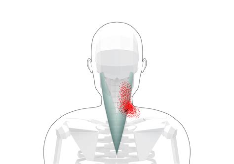 Infraspinatus Trigger Points Overview And Tips For Self Treatment