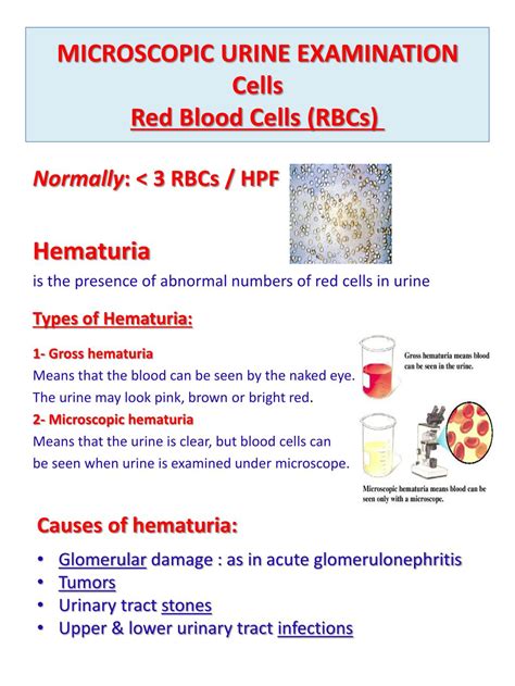 Ppt Urine Analysis Powerpoint Presentation Free Download Id2139443