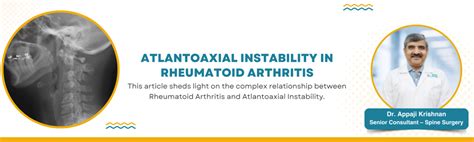 Atlantoaxial Instability in Rheumatoid Arthritis