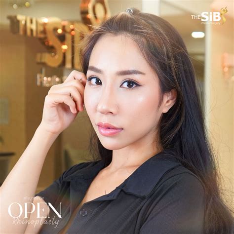 สวยรับทรัพย์แก้จมูกปรับโหงวเฮ้ง The Sib Plastic Surgery คลินิก