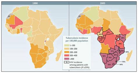 Tuberculosis In Africa — Combating An Hiv Driven Crisis Nejm