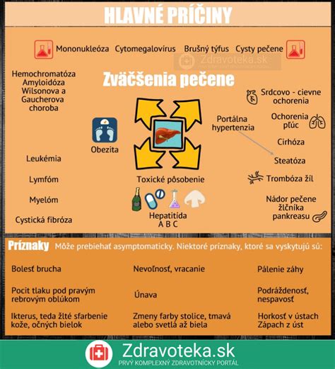 Infografika Zväčšenie pečene príčiny a príznaky Zdravoteka sk