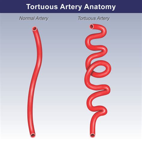 Anatomy Of The Cornea Trial Exhibits Inc