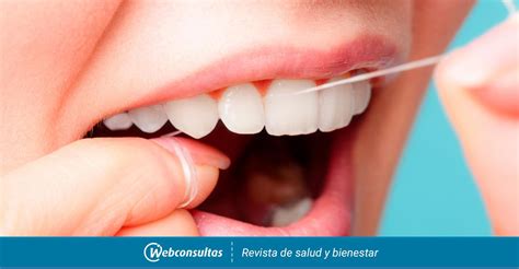 Descubre C Mo Prevenir La Placa Dental En Simples Pasos