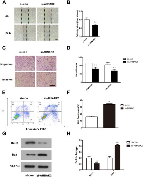 Down Regulation Of AHNAK2 Inhibits Cell Proliferation Migration And