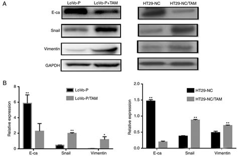 Co Culture Of Tams And Lovo P Or Ht29 Nc Cells Promotes Emt A