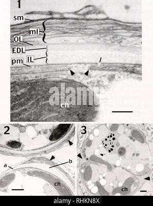 Uranyl Acetate, TEM Stock Photo - Alamy