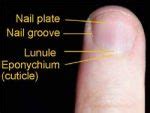 Fingernail Cuticle Care - Cuticle Infection, Paronychia, Care Cuticles ...